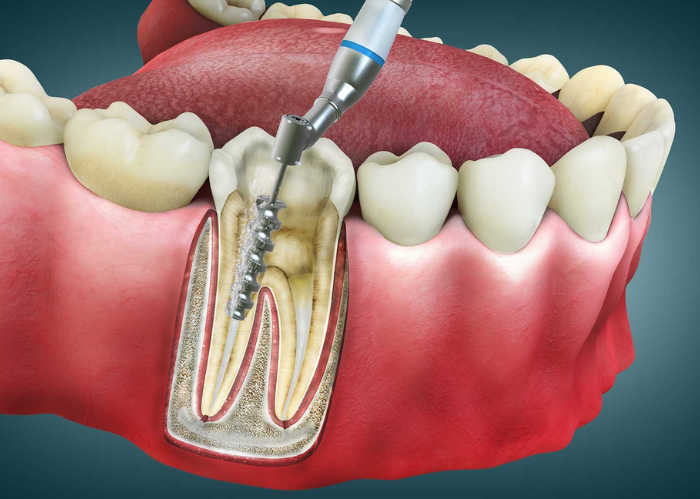 Blog Image